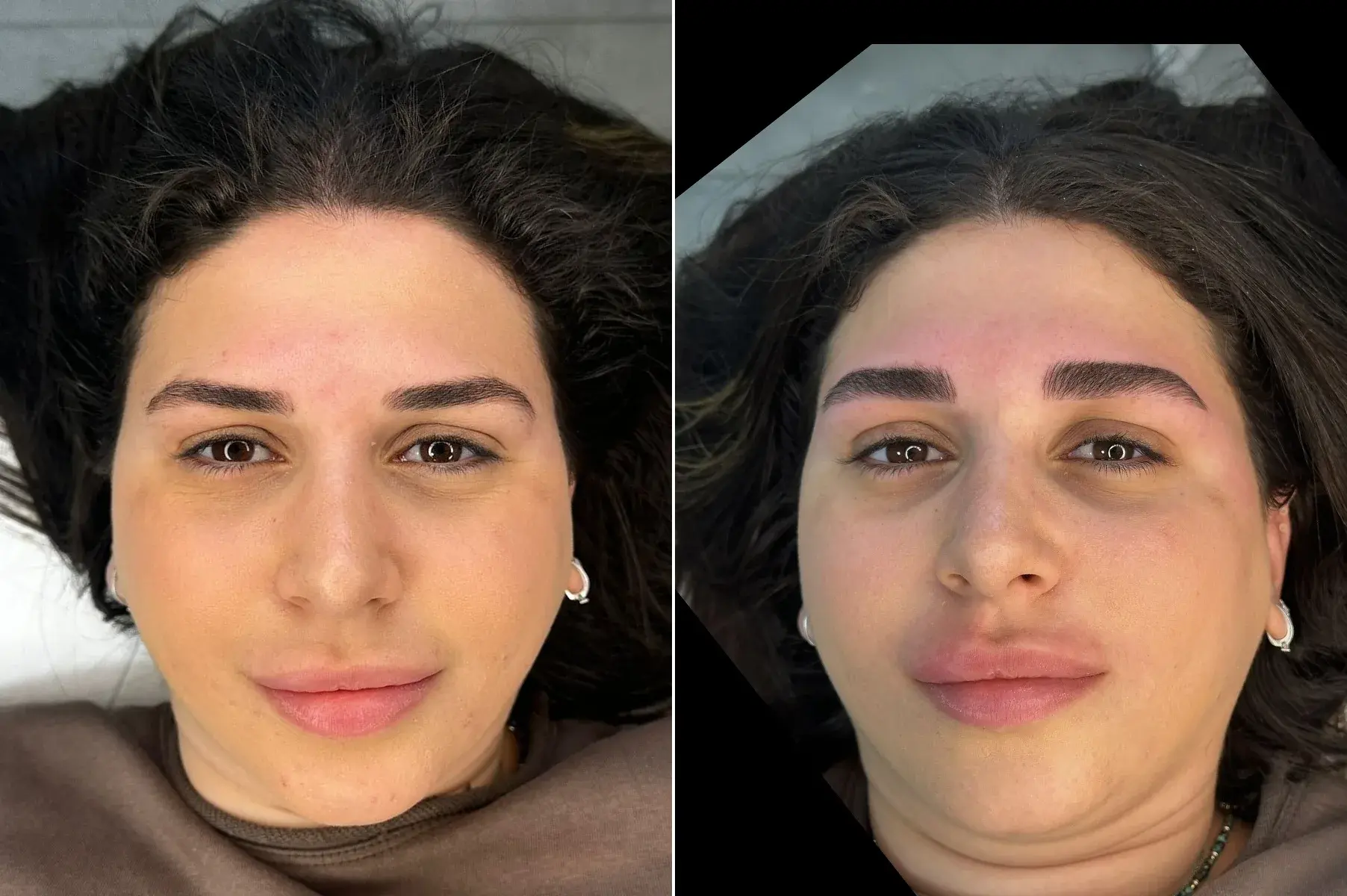 מיקרובליידינג לפני ואחרי 5