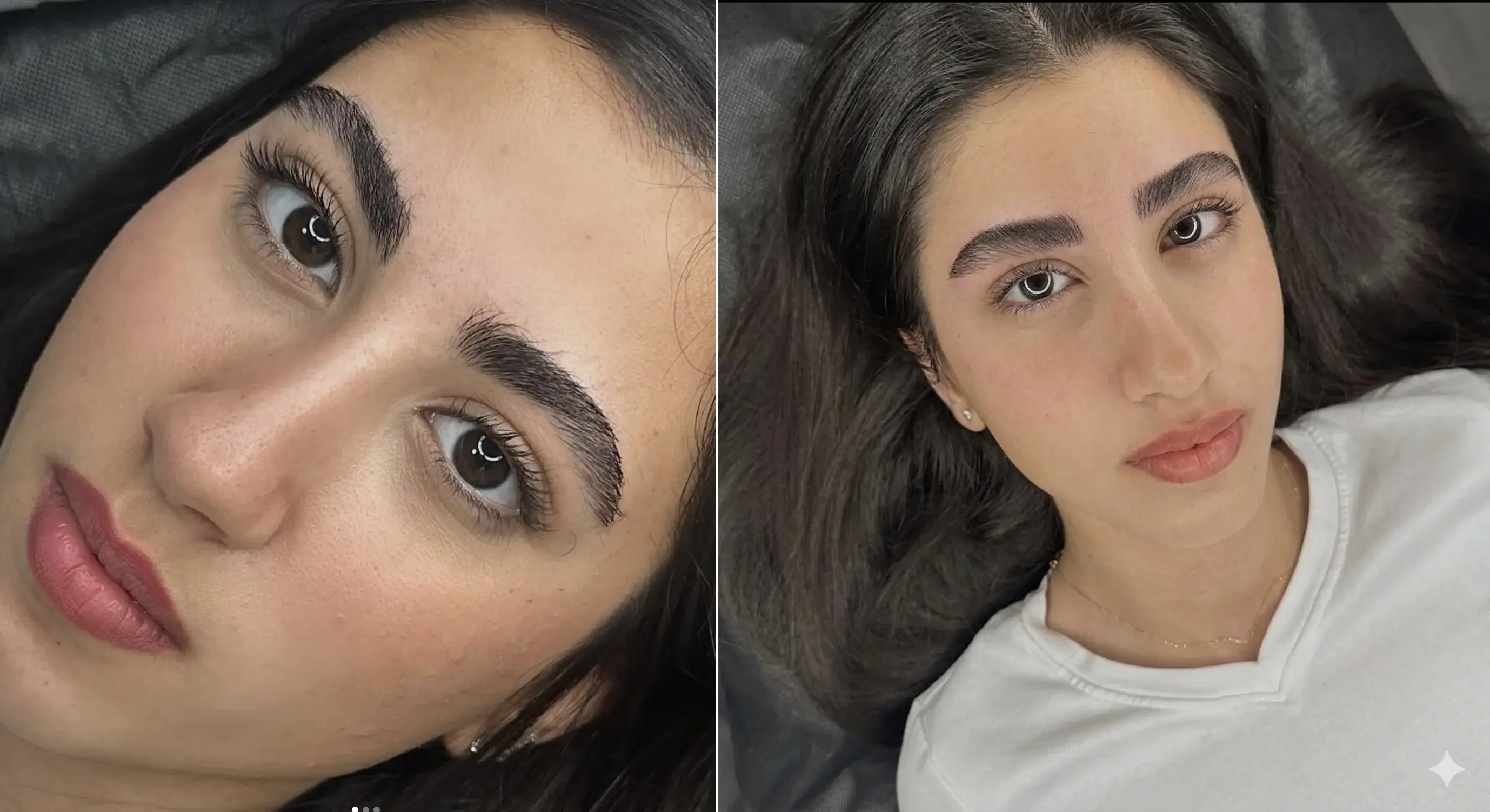 מיקרובליידינג לפני ואחרי 8